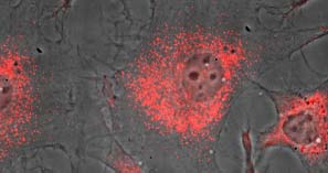 ANOVA Institute for Regenerative Medicine - Das Potential von Exosomen erklärt