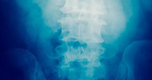 ANOVA Institute for Regenerative Medicine - Combined Treatment for Spinal Cord Injury: Stem Cell Therapy and HAL