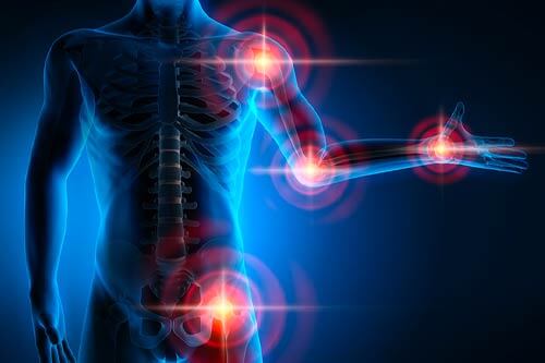 anova institute for regenerative medicine article Generic risk osteoarthritis