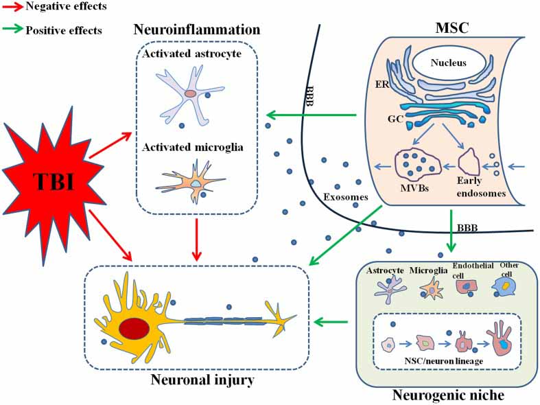 Neurodegeneration Traumatic Brain Injuri effects of exosomes