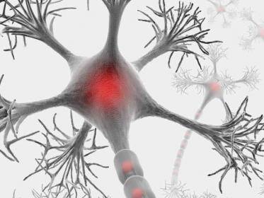 Multiple Sclerosis