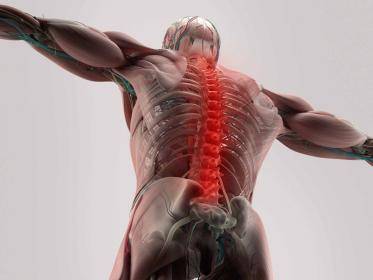 Spinal Cord Injury