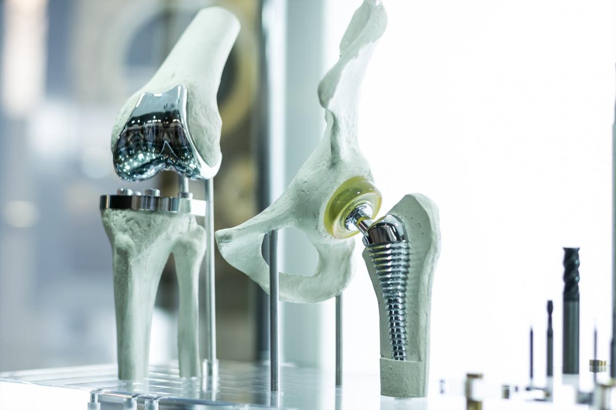 Regenerative Therapie bei Gelenkbeschwerden Regenerative Therapie bei Gelenkbeschwerden | ANOVA IRM