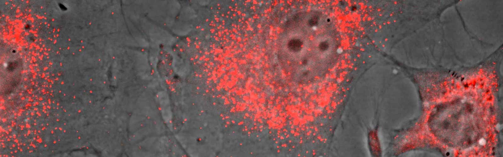 anova institute for regenerative medicine - the power of exosomes